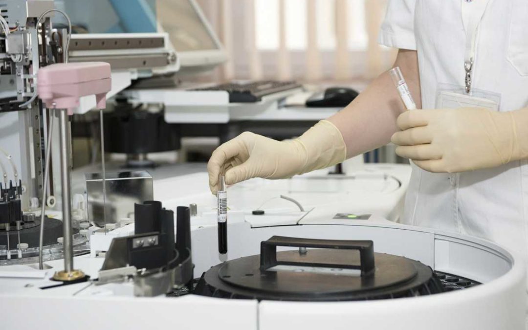 Mladá Číňanka na Opavsku nemá koronavirus, vyloučili to lékaři