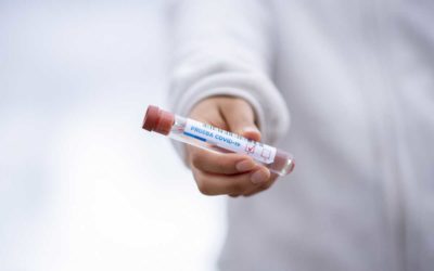 Podhorská nemocnice v Bruntále nově testuje samoplátce na SARS-CoV-2
