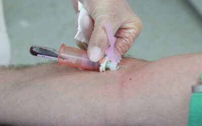 Zdravotní ústav se sídlem v Ostravě nabízí veřejnosti bezplatné anonymní testování HIV